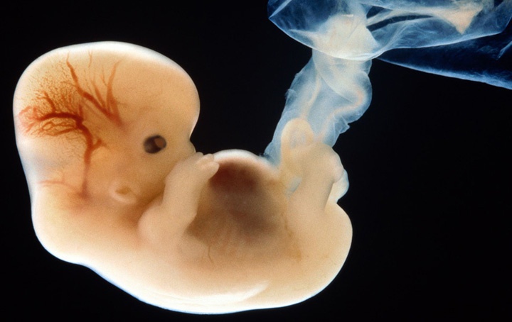 фотография эмбриона на 8 неделе беременности