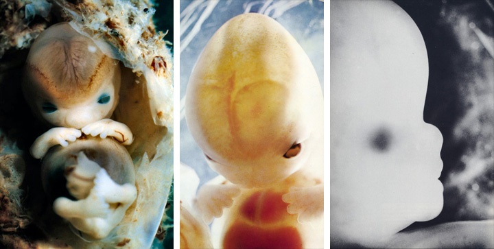 фотографии эмбриона на 9 неделе беременности