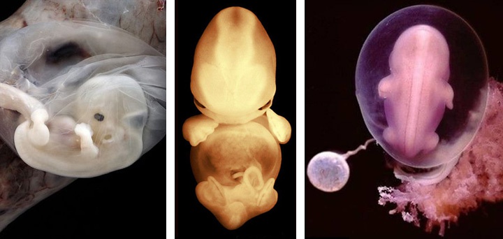 фотографии эмбрионов на 8 неделе беременности