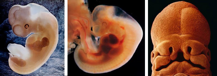 фотографии эмбрионов на 7 неделе беременности
