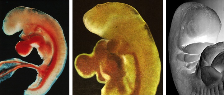 фотография эмбриона на 6 неделе беременности