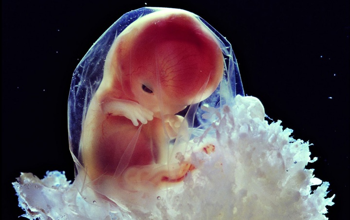 фотография эмбриона на 10 неделе беременности