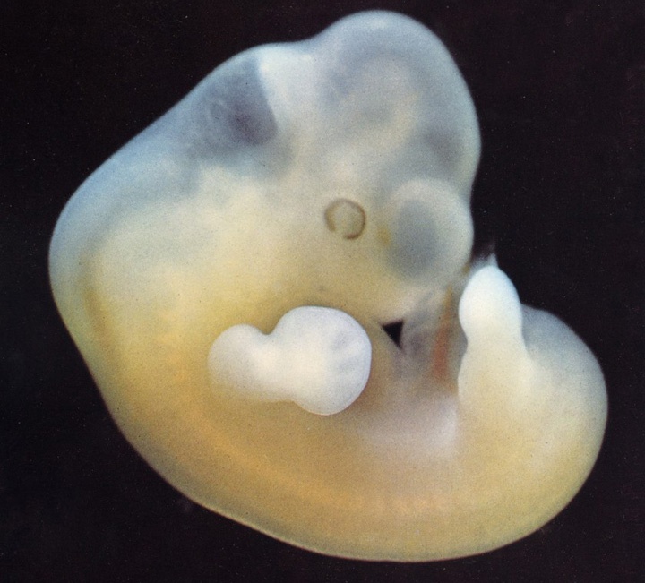 фотография эмбриона в 7 недель беременности