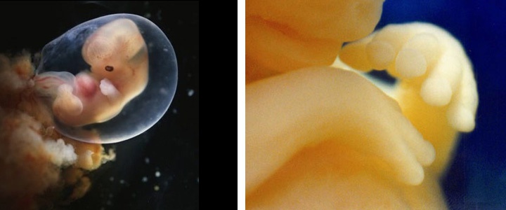 фотография эмбриона на 9 неделе беременности