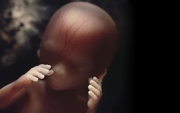 фотография ребенка на 18 неделе беременности