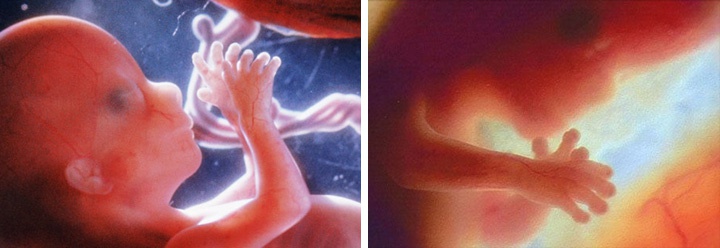 фотографии малыша на 14 неделе беременности