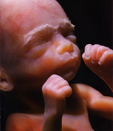 фотография ребенка на 25 неделе беременности