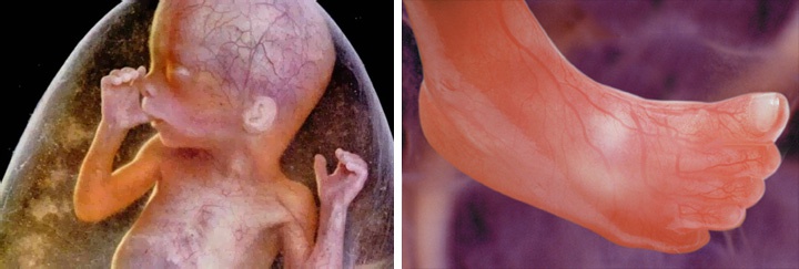 фотографии ребенка на 20 неделе беременности
