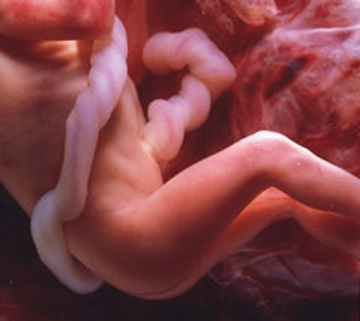 фотография ребенка на 30 неделе беременности