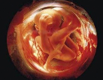 фотография ребенка на 34 неделе беременности