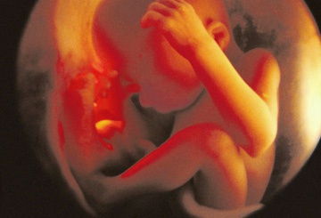 фотография ребенка на 33 неделе беременности